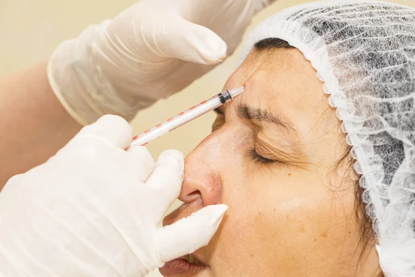 Tratamento cosmético com injeção de botox — Fotografia de Stock