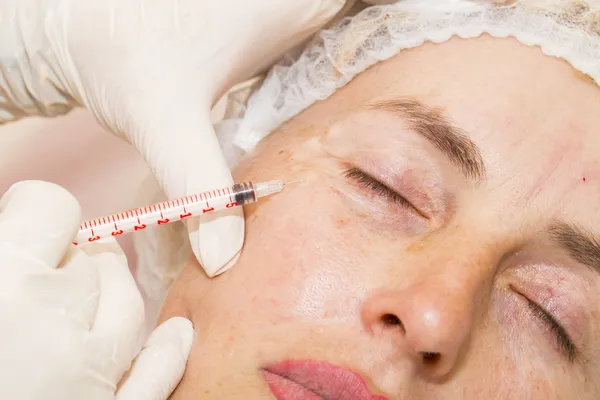 Cosmetic treatment with botox injection — Stock Photo, Image