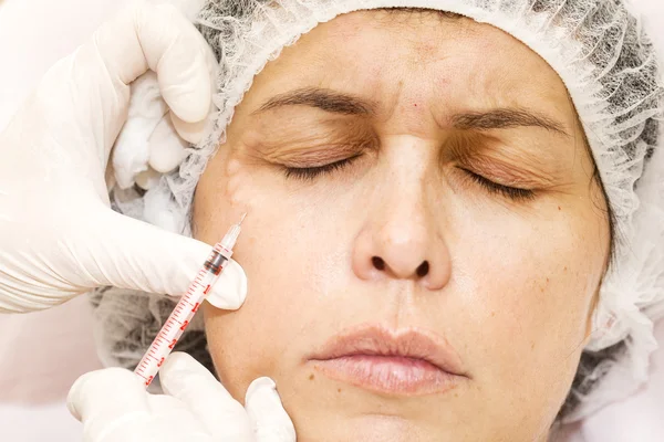 Kosmetisk behandling med botox injektion — Stockfoto