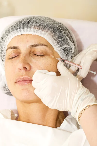 Cosmetic treatment with botox injection — Stock Photo, Image