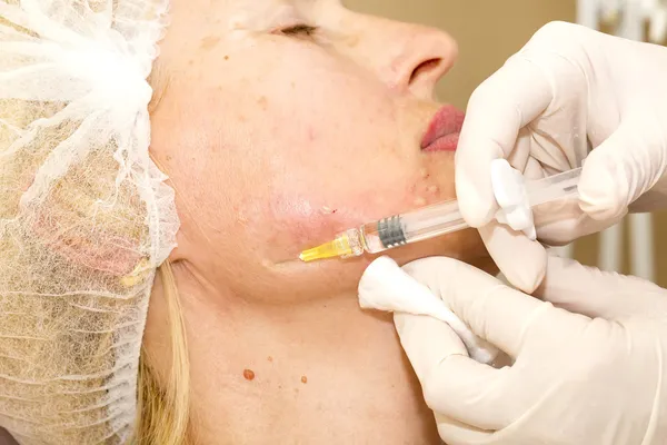 Cosmetische behandeling met botox injectie — Stockfoto