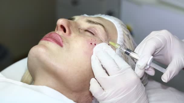 Kozmetik tedavisi botox enjeksiyonu ile — Stok video