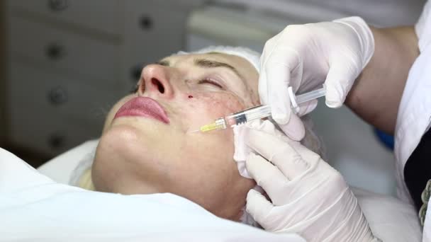 Kosmetisk behandling med botox injektion — Stockvideo