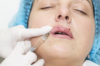 kozmetik tedavisi botox enjeksiyonu ile