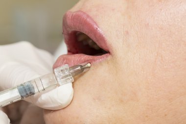 kozmetik tedavisi botox enjeksiyonu ile