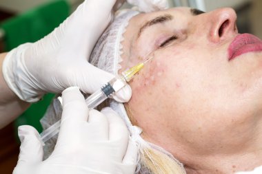 kozmetik tedavisi botox enjeksiyonu ile