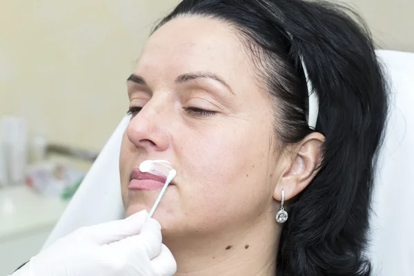 Tratamento cosmético com injeção de botox — Fotografia de Stock