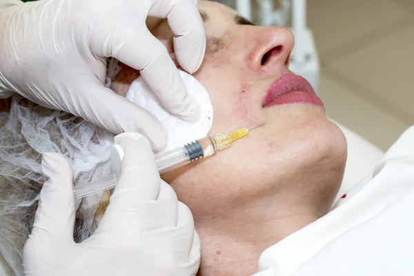 Косметическое лечение инъекцией ботокса — стоковое фото