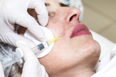 kozmetik tedavisi botox enjeksiyonu ile