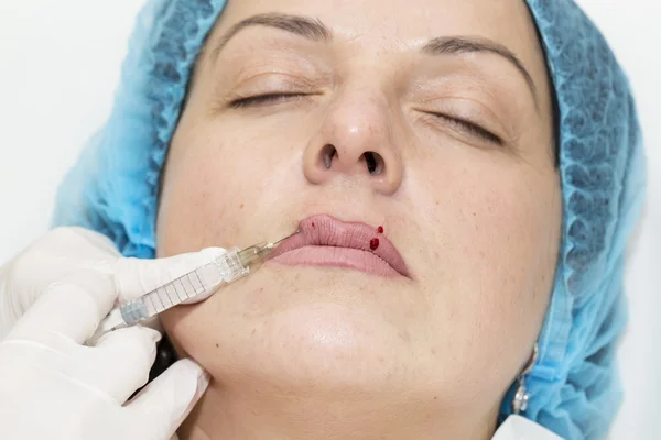 Cosmetische chirurgie — Stockfoto