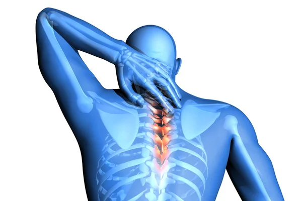 Spine pain - vertebrae trauma — Stock Photo, Image