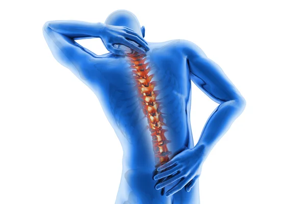 Dolor de columna vertebral Imagen De Stock