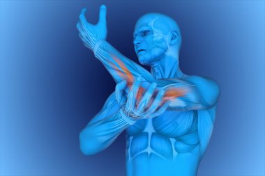 digital illustration Elbow pain
