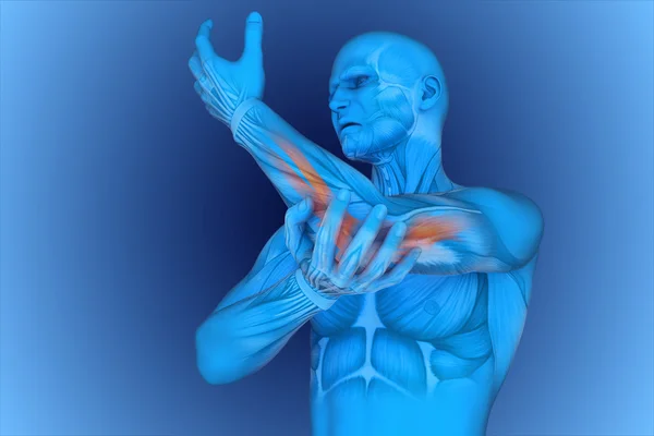 Digital illustration armbågen smärta — Stockfoto