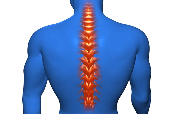 Visão anatômica dor nas costas — Fotografia de Stock