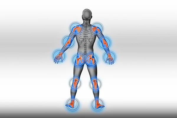 eklemler ağrı - travma