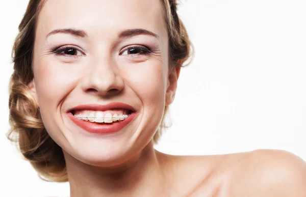 Sorria com aparelho dentário — Fotografia de Stock