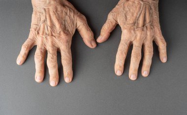 Kırış kırış elleri ve damarları yakın..