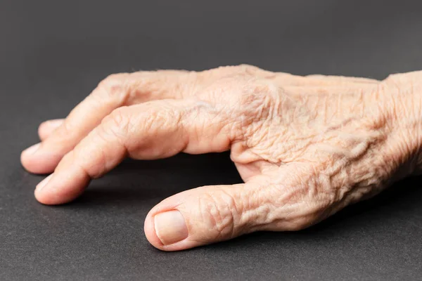 Textured wrinkled hand of an old man on a dark background. Close-up view.