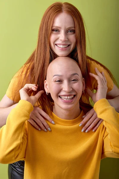 Two Diverse European Redhead Hairless Ladies Models Hugging Isolated Green — Photo