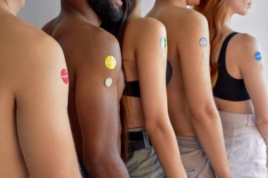 young people standing in line, in queue after vaccination. indoors. side view, close-up arms. cropped unrecognizable men and women with different skin color, global immunization concept