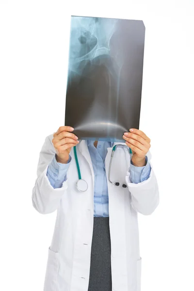 Doctor woman holding fluorography in front of face — Stock Photo, Image