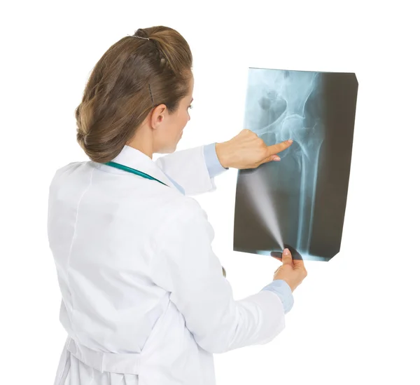 Doctor woman pointing on fluorography . rear view — Stock Photo, Image