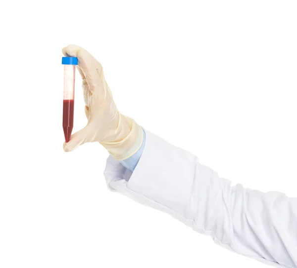 Closeup on test tube in hand of doctor — Stock Photo, Image