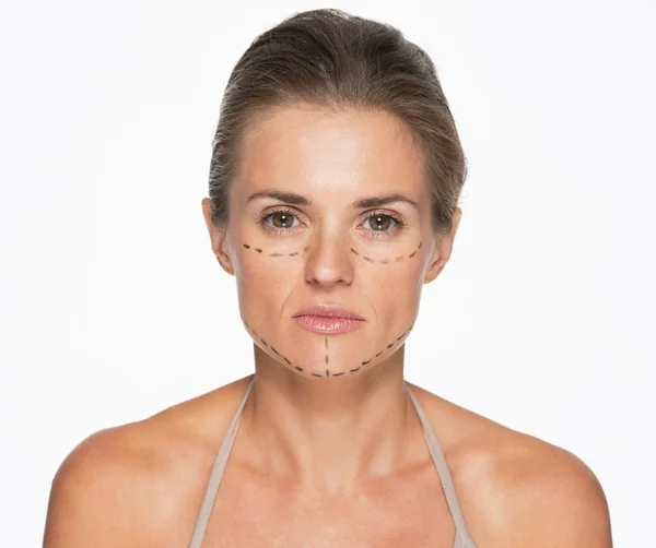 Vrouw met plastische chirurgie merken — Stockfoto