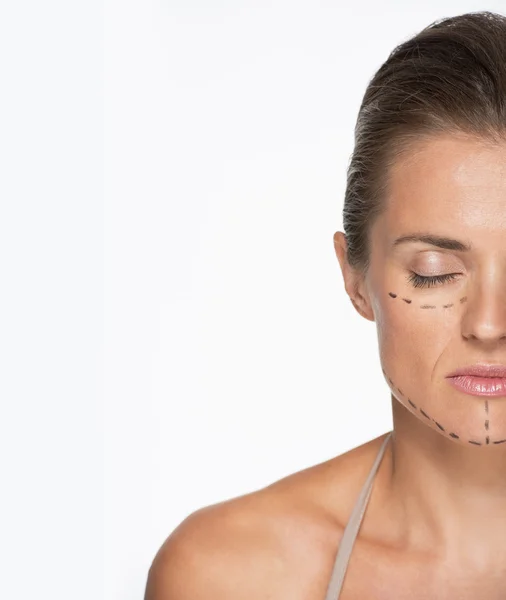 Woman with plastic surgery marks — Stock Photo, Image