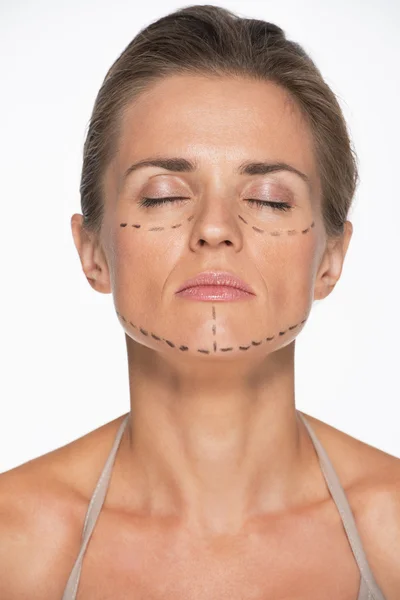 Woman with plastic surgery marks — Stock Photo, Image