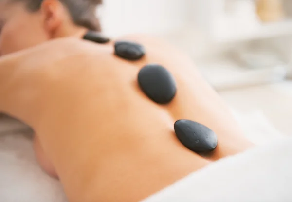 Primer plano de la mujer joven recibiendo masaje de piedra caliente. visión trasera — Foto de Stock