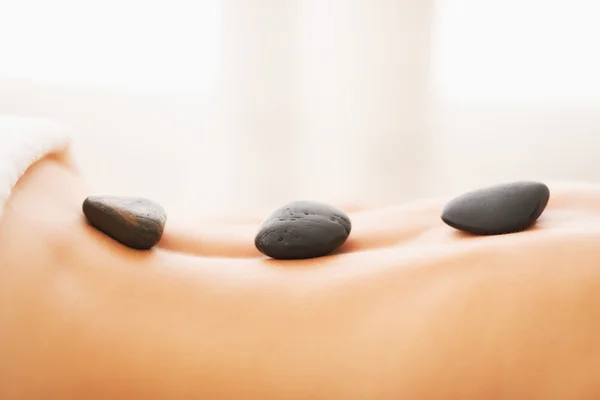 Крупним планом на молоду жінку, що отримує масаж гарячим каменем — стокове фото