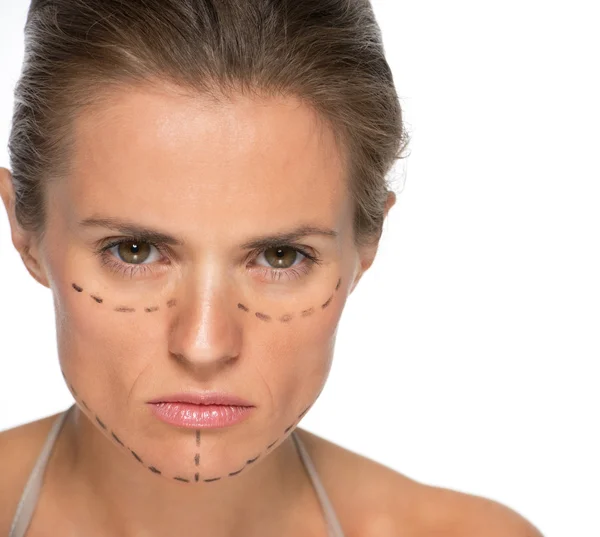 Concerned woman with plastic surgery marks — Stock Photo, Image