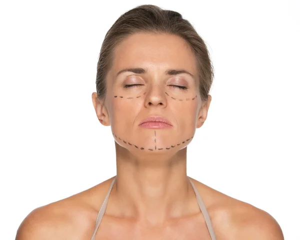 Woman with plastic surgery marks — Stock Photo, Image