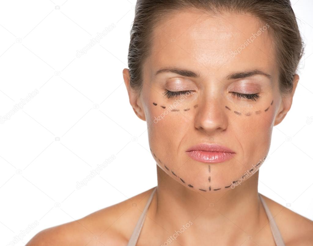 Woman with plastic surgery marks