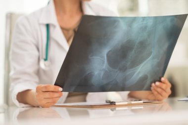 Doktor kadın holding fluorography