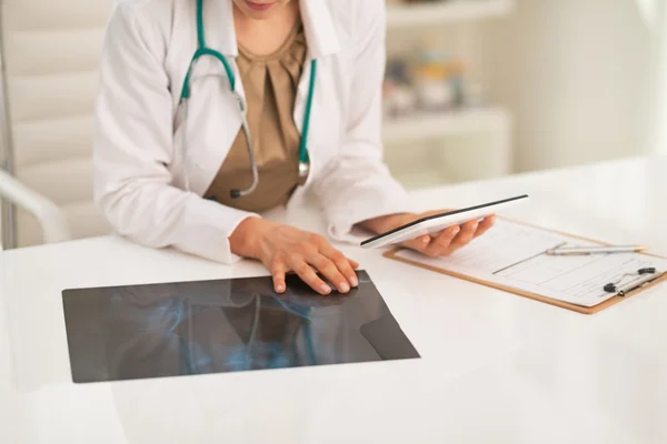 Doctora mujer con fluorografía —  Fotos de Stock