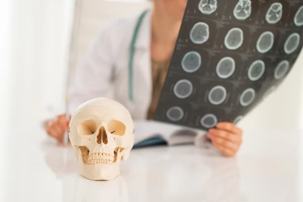 Human skull and doctor — Stock Photo, Image