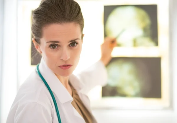 Medico che punta tomografia su lightbox — Foto Stock