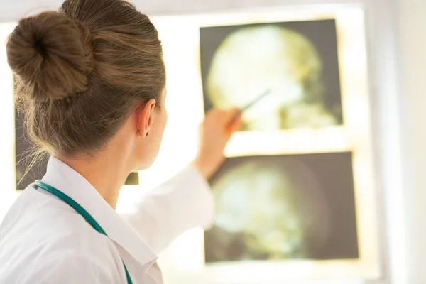 Doktor žena ukazující na tomografie. — Stock fotografie