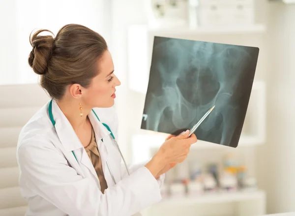 Médico mulher apontando na fluorografia — Fotografia de Stock