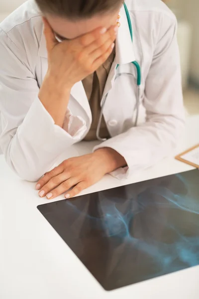 Stressed doctor woman with fluorography — Stock Photo, Image