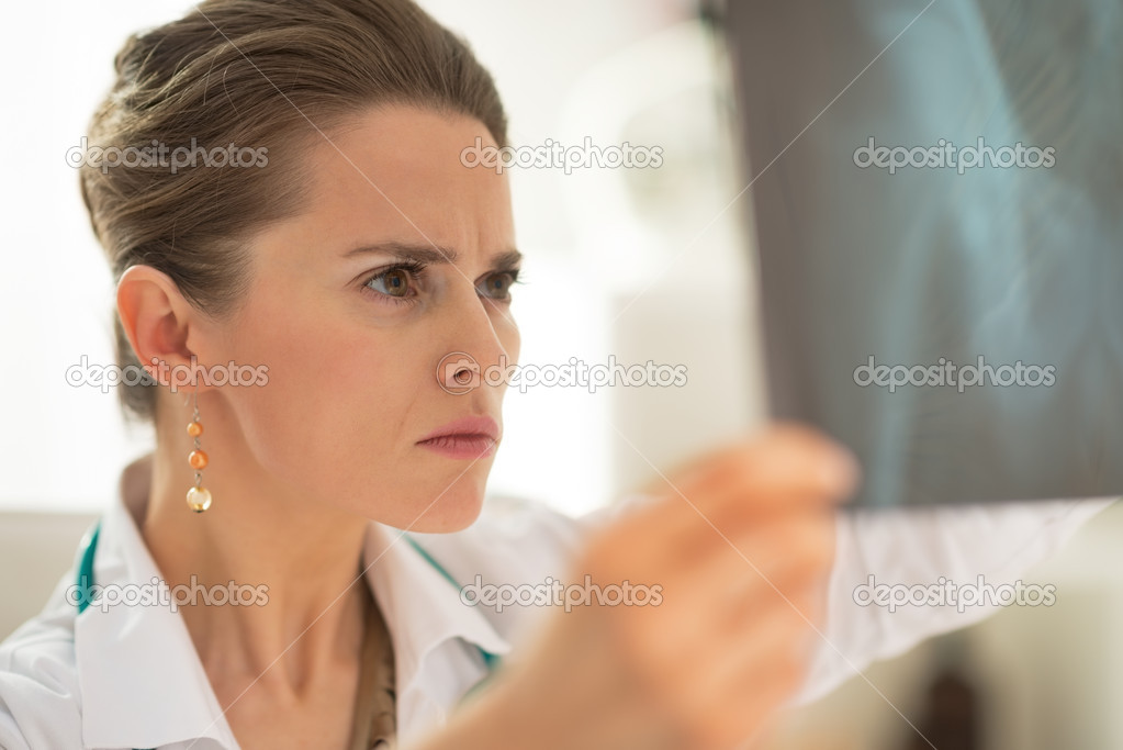 Concerned doctor woman looking on fluorography
