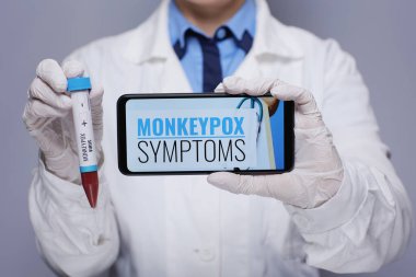 Maymun çiçeği test tüpüyle modern kadın tıp doktoruna yakından bakın. Maymun hastalığı belirtileri gösteren akıllı telefon gri ekranda izole edilmiş..