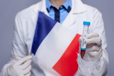 female medical doctor in white medical robe with monkeypox test tube and French flag isolated on grey background.