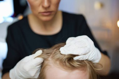 Closeup on woman trichologist in rubber gloves checking child hair.