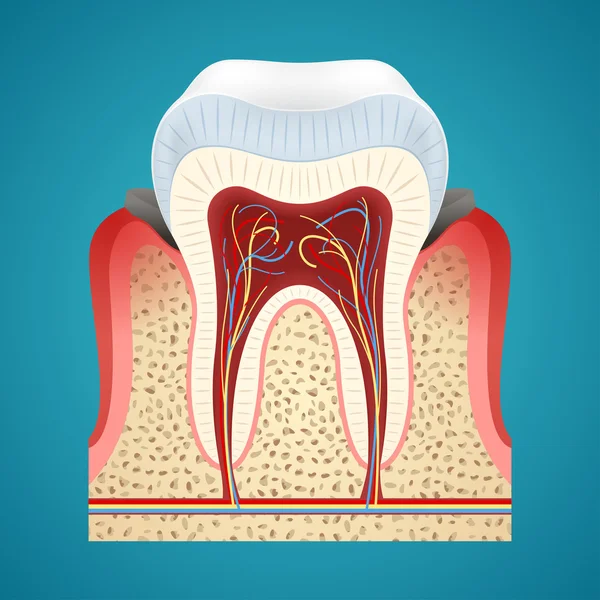 人間の歯の病気ガムと齲蝕を開始 — ストックベクタ