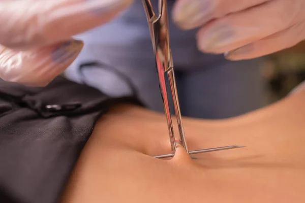 Das erste Piercing. Die Ohrringe am Bauchnabel anlegen. weibliches Piercing. Stockfoto