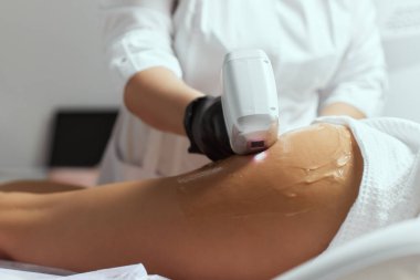 Genç Afrikalı kadın uyluklarına lazer kılı aldırıyor..